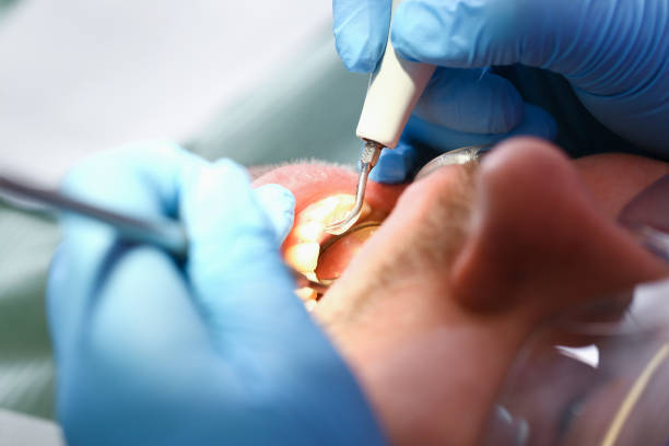 Best Walk-In Emergency Dental Services in Pendleton, OR